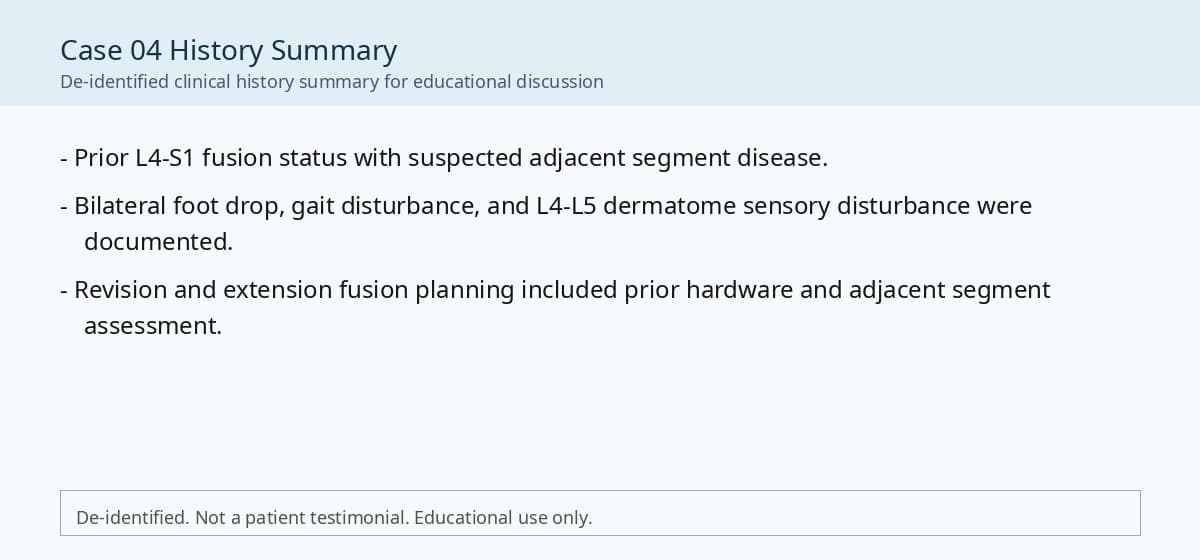 De-identified clinical history summary for adjacent segment disease case.