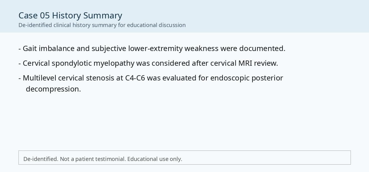 De-identified clinical history summary for cervical spondylotic myelopathy case.